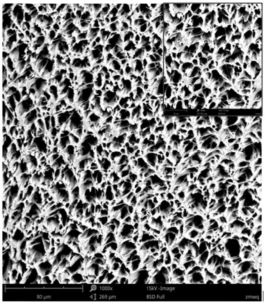 Medical catheter hydrogel coating as well as preparation method and application thereof