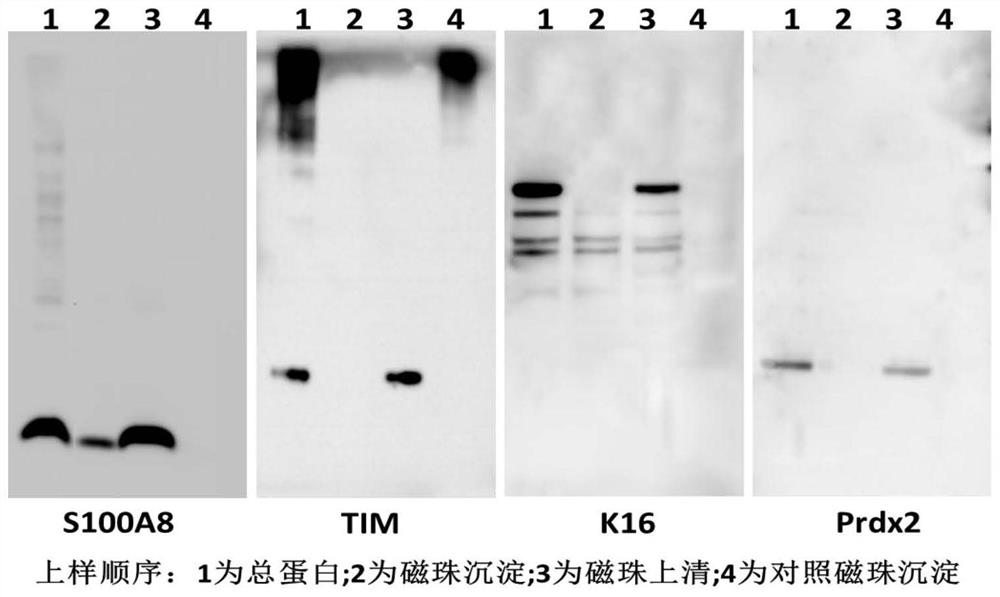 Pharmaceutical application of rhein as S100A8 inhibitor in inflammatory diseases