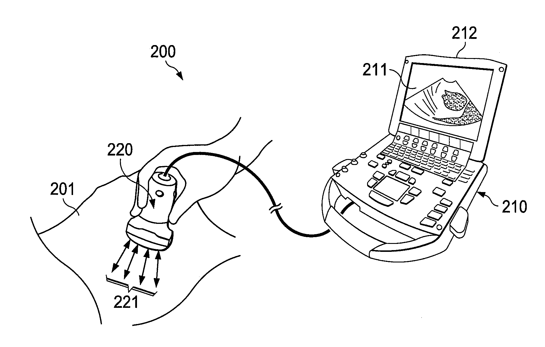 Systems and methods for beam enhancement