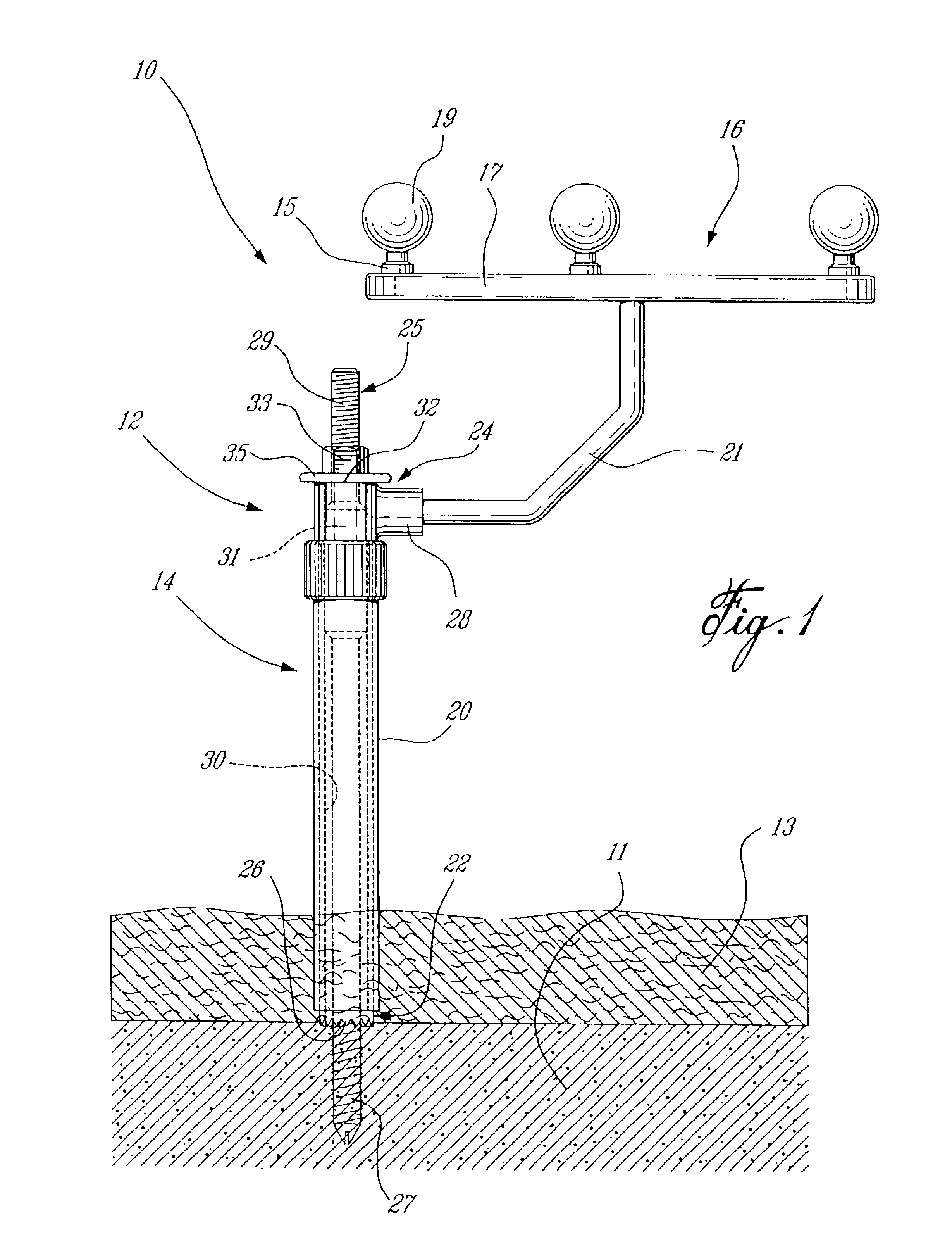 CAS bone reference and less invasive installation method thereof