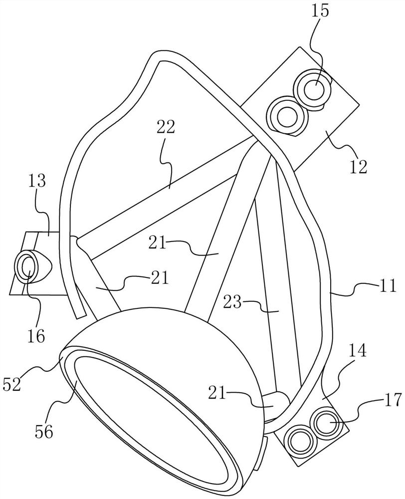 Long-term implanted acetabular prosthesis and application thereof