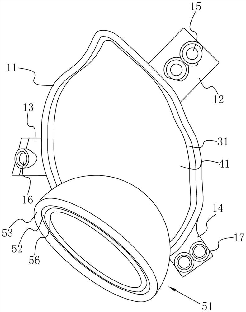 Long-term implanted acetabular prosthesis and application thereof