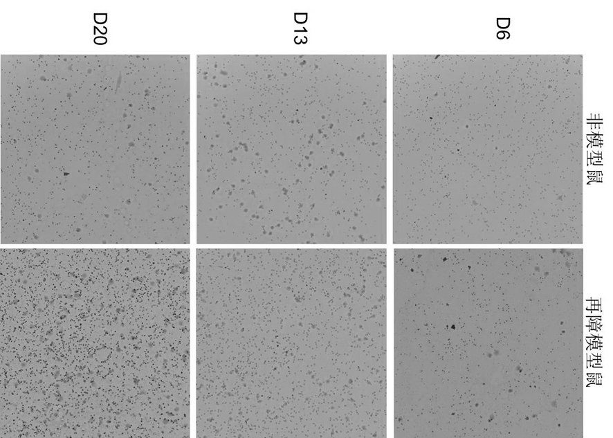 Application of irisin in the preparation of medicine for the treatment of aplastic anemia