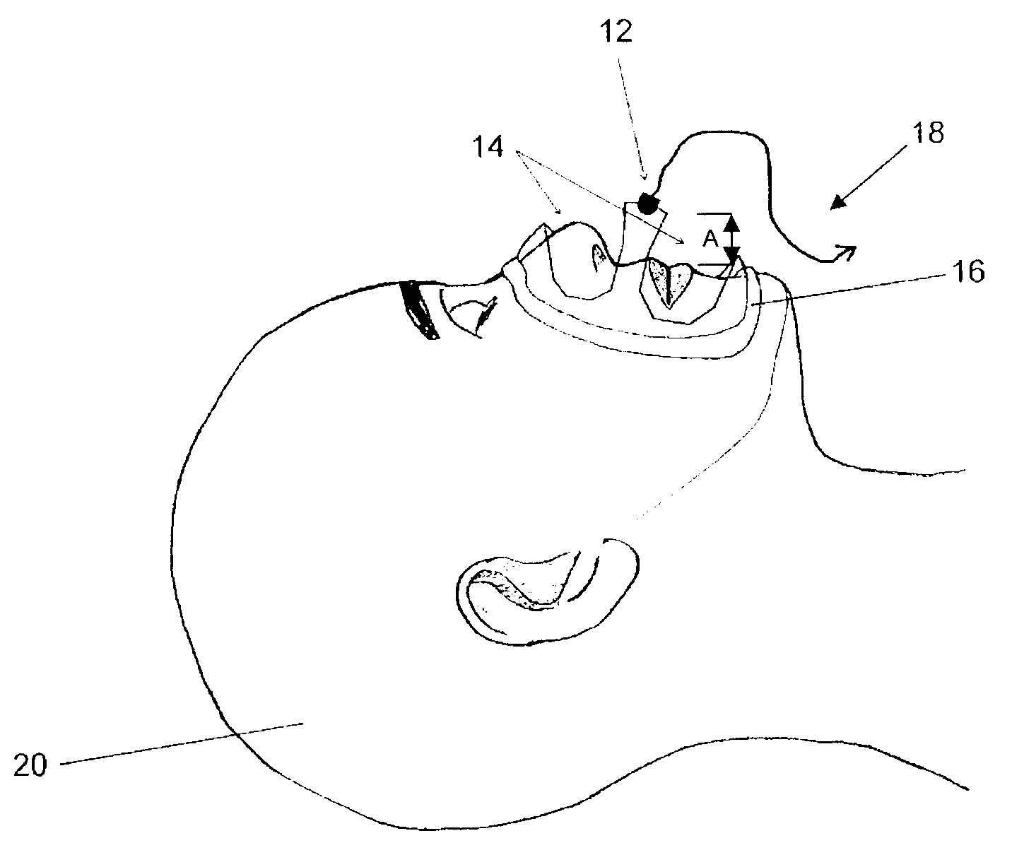 Method and apparatus for monitoring breathing cycle by frequency analysis of an acoustic data stream