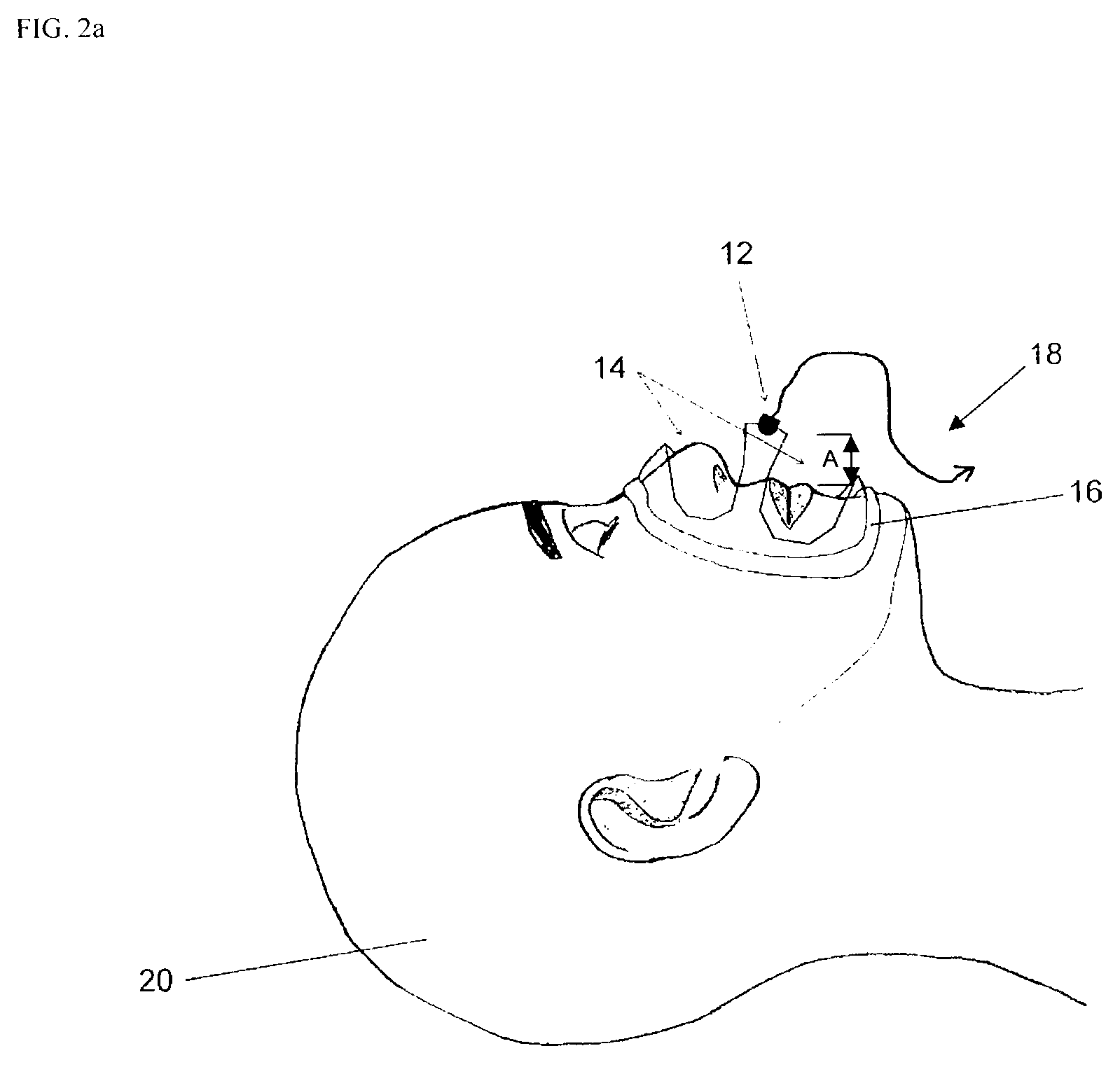 Method and apparatus for monitoring breathing cycle by frequency analysis of an acoustic data stream