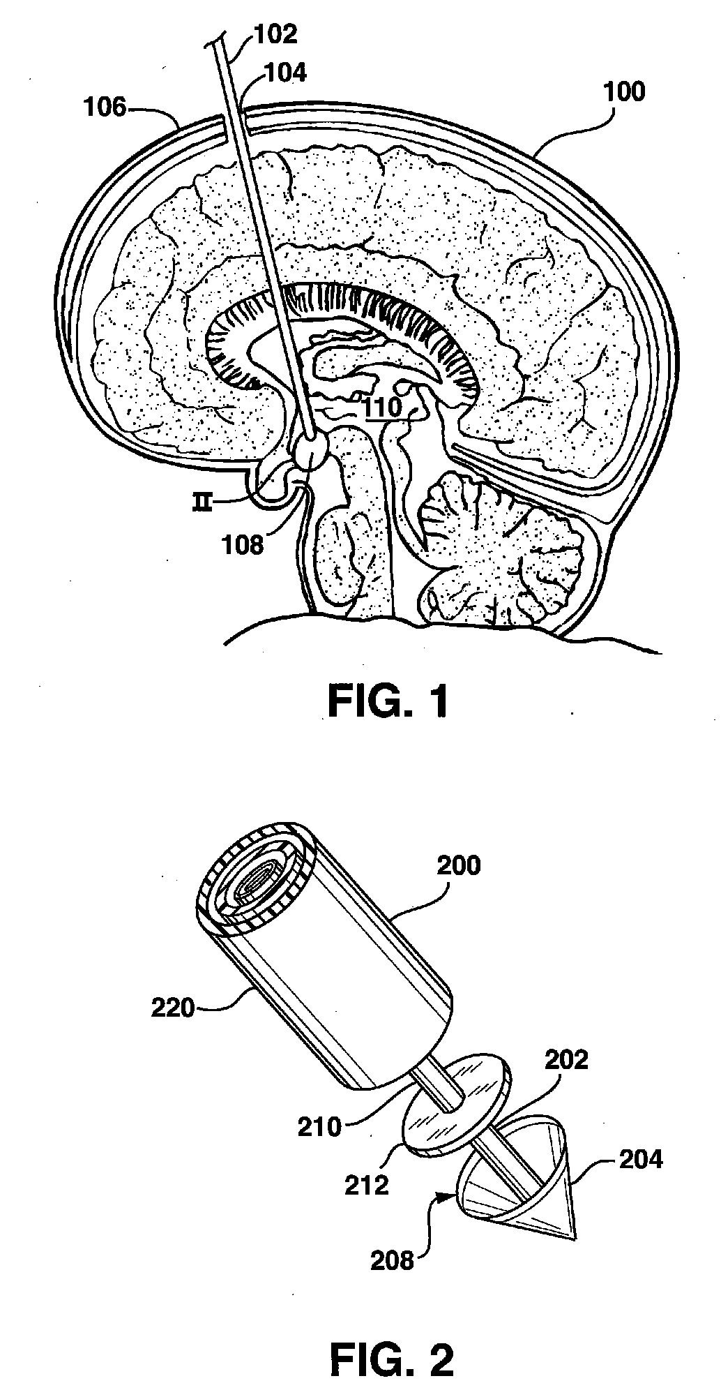Apparatus and Methods for Creating an Opening in a Tissue Membrane
