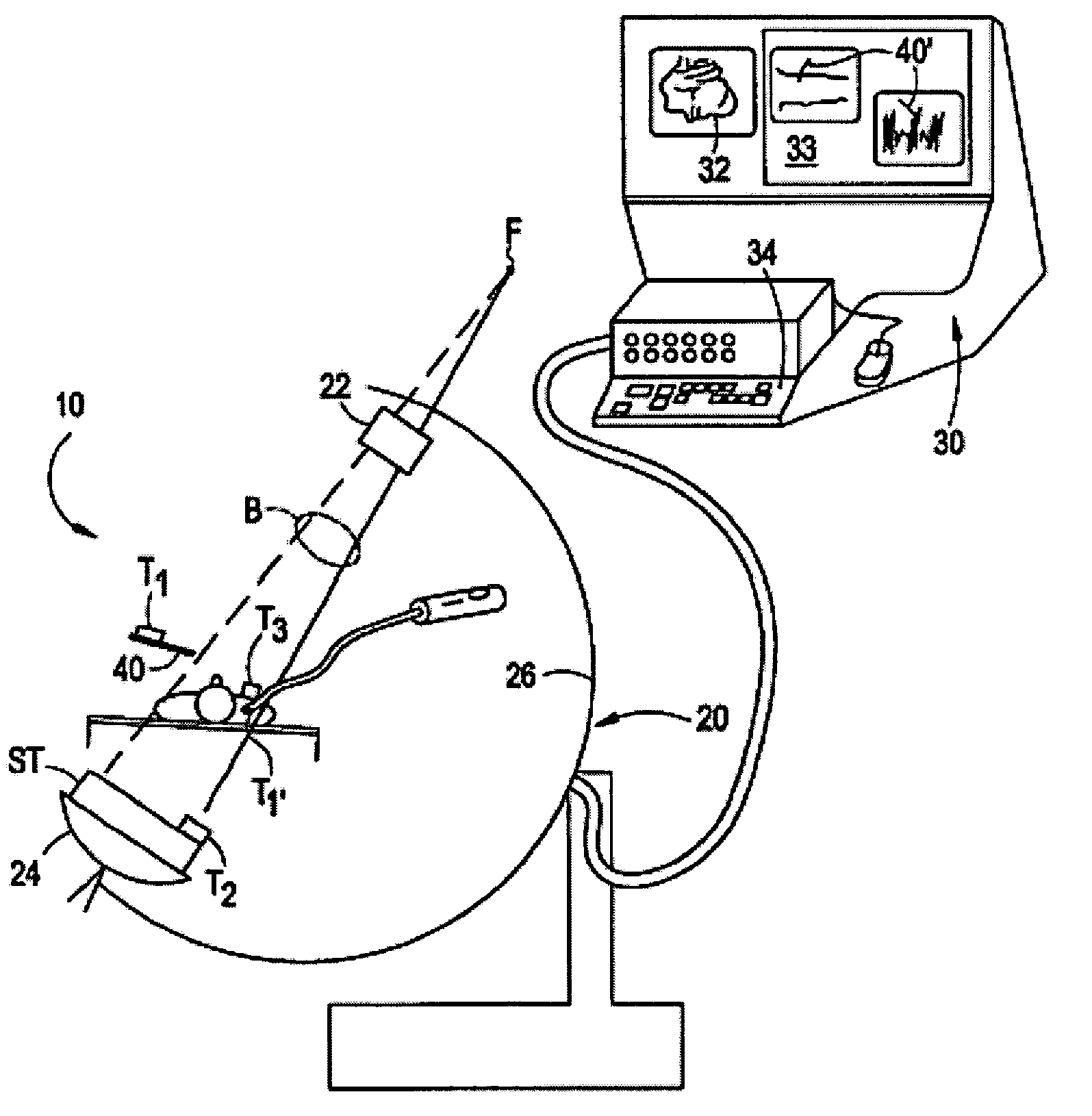 Method and system for improved correction of registration error in a fluoroscopic image