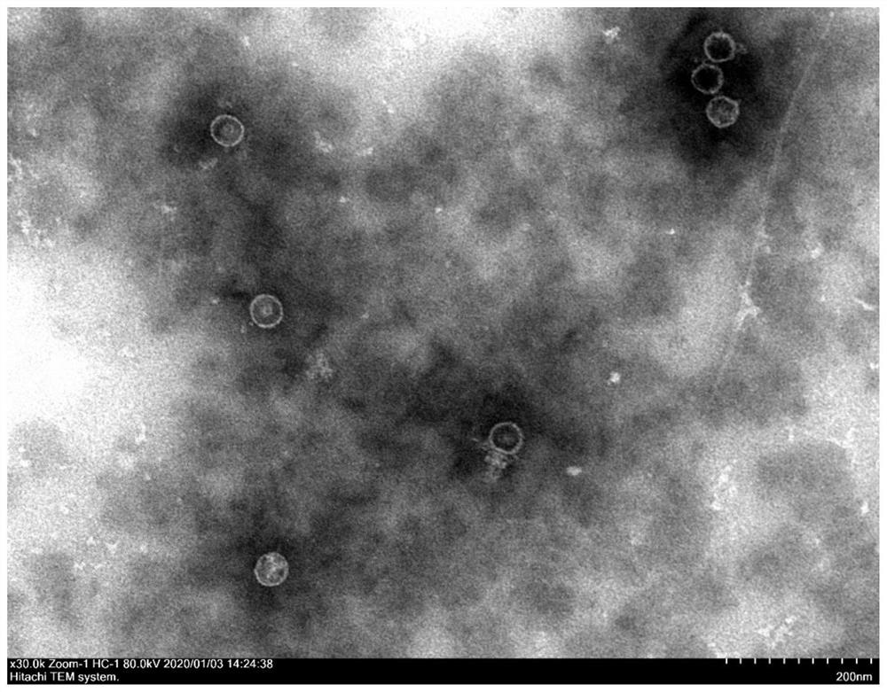 A strain of Clostridium welchii phage, its phage composition and its application