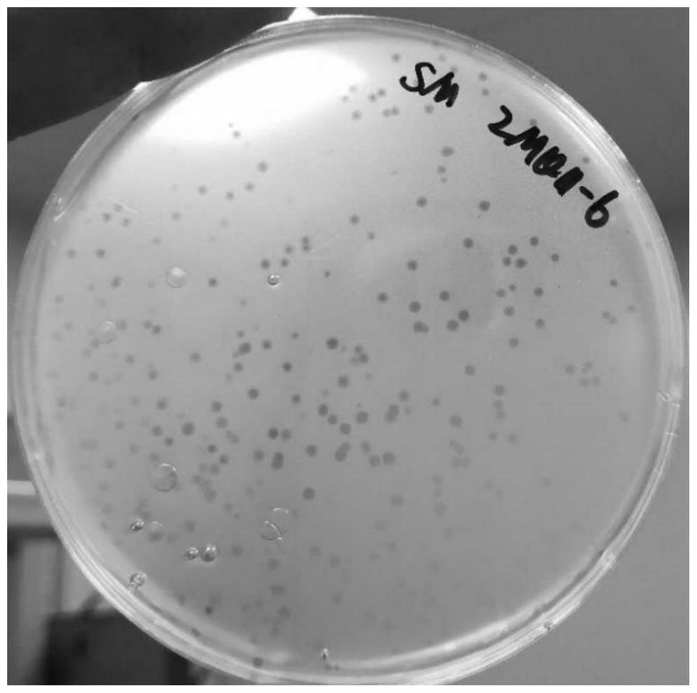 A strain of Clostridium welchii phage, its phage composition and its application