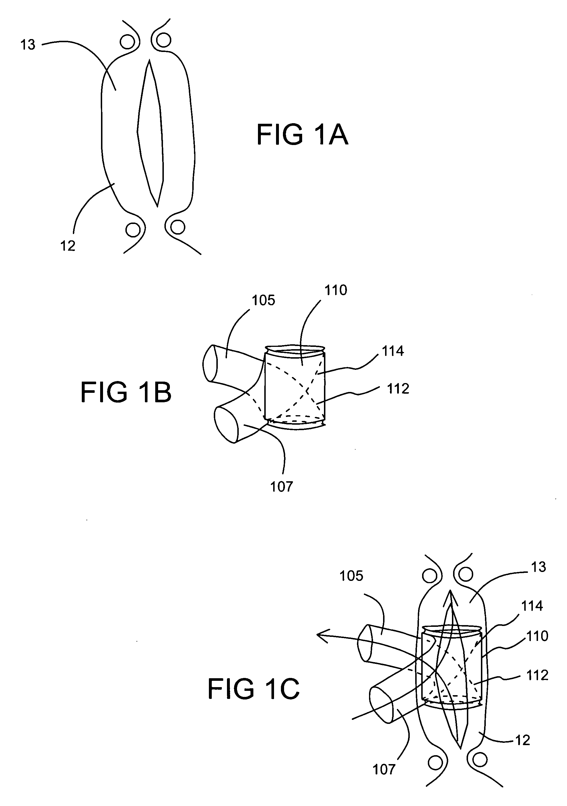 Devices, systems and methods for assisting blood flow