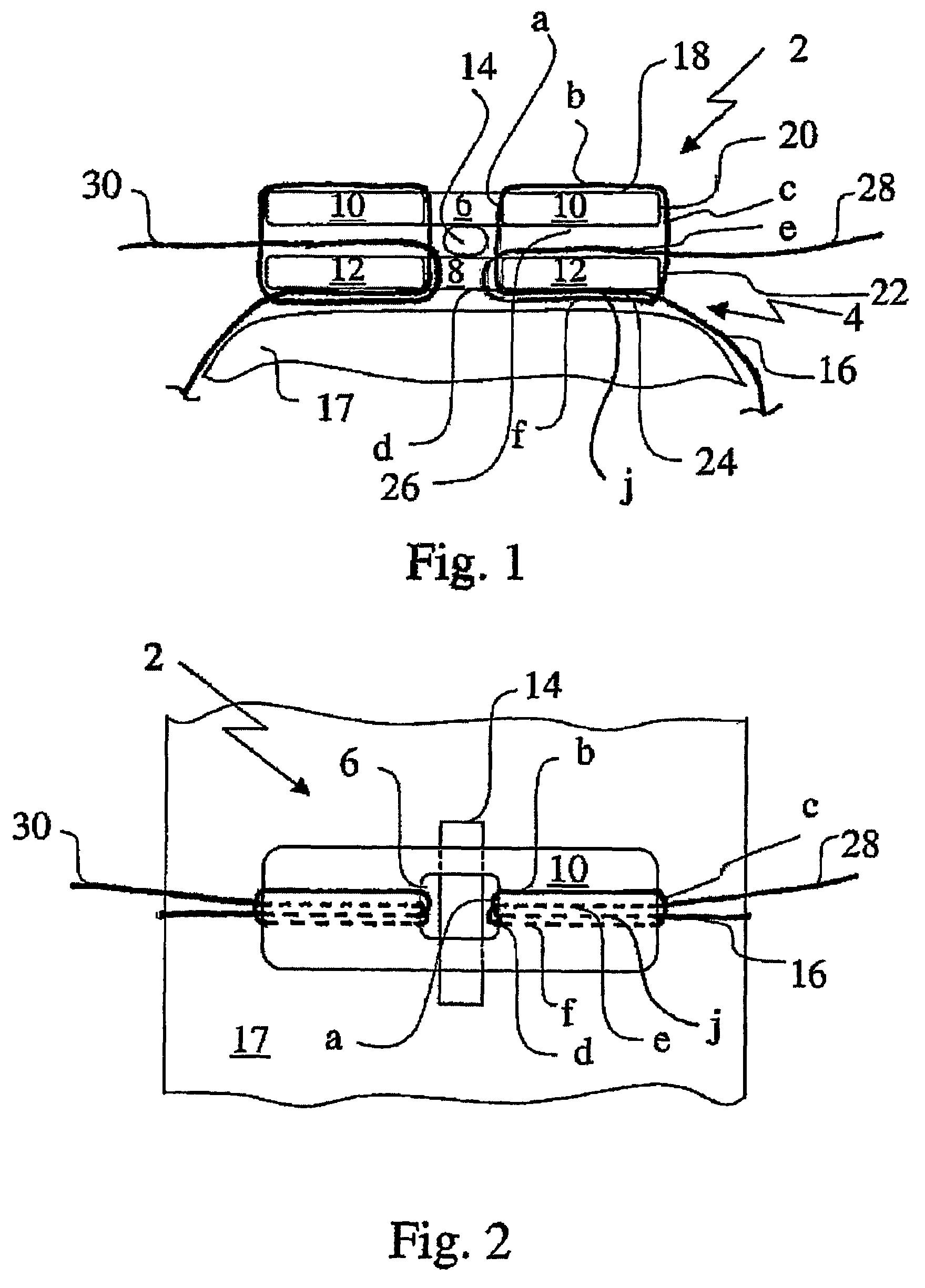 Bone fixing device