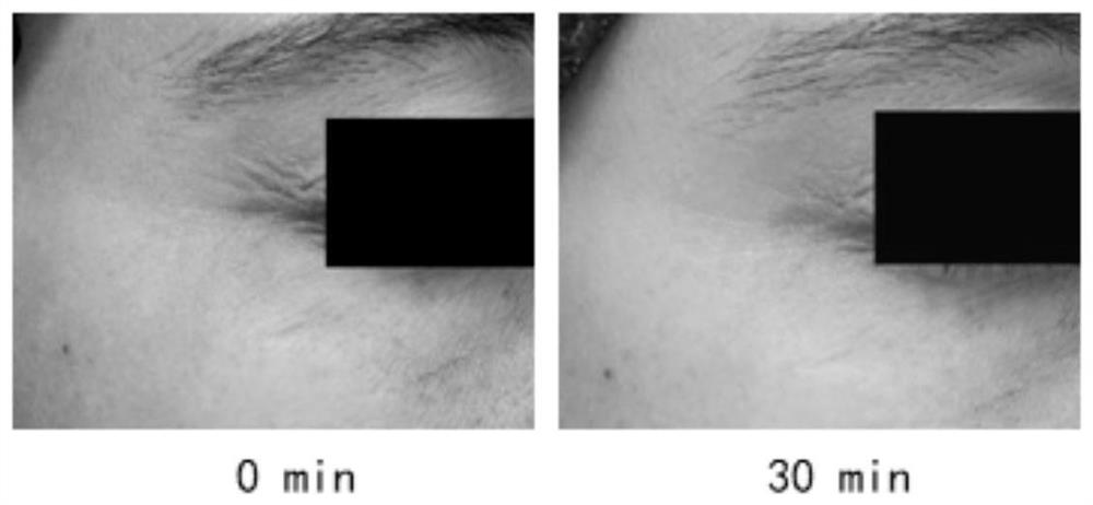 Eye anti-aging composition and application thereof