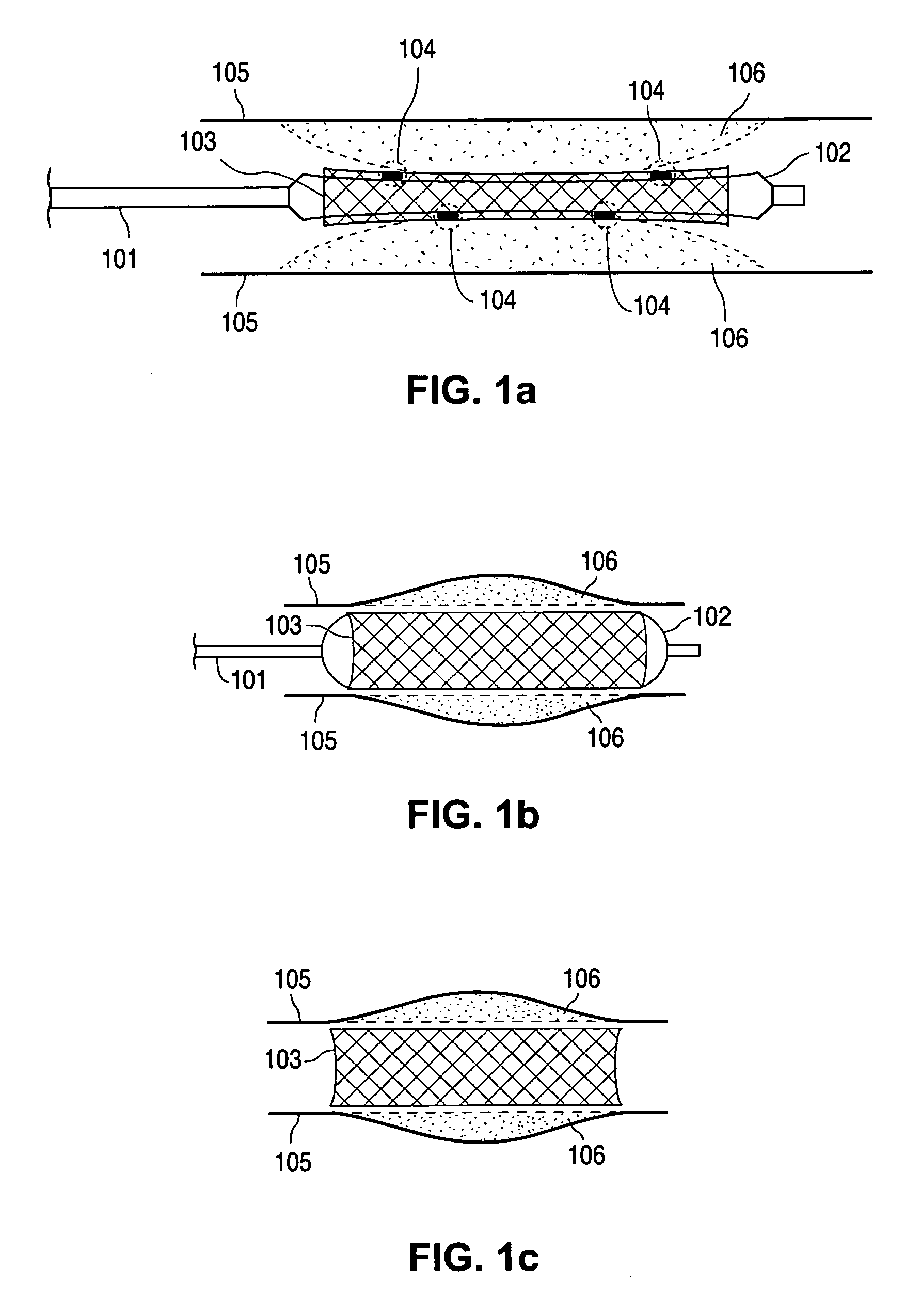 Compositions containing fast-leaching plasticizers for improved performance of medical devices