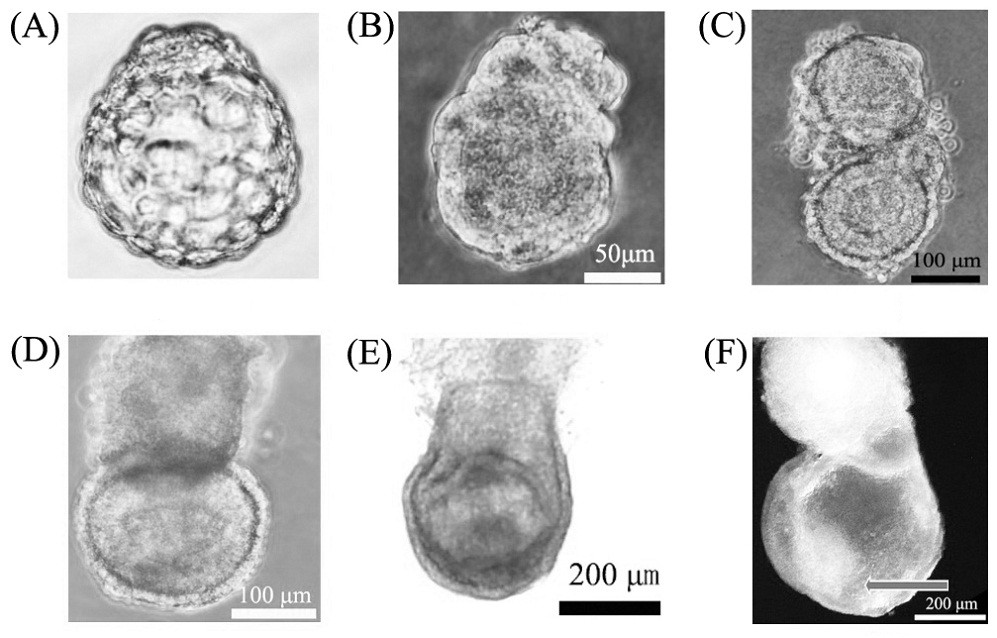 Culture medium for epitaxy culture of mouse embryo body