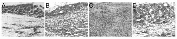 Tube pressing-type chronic nerve root injury model in animal and constructing method and application thereof