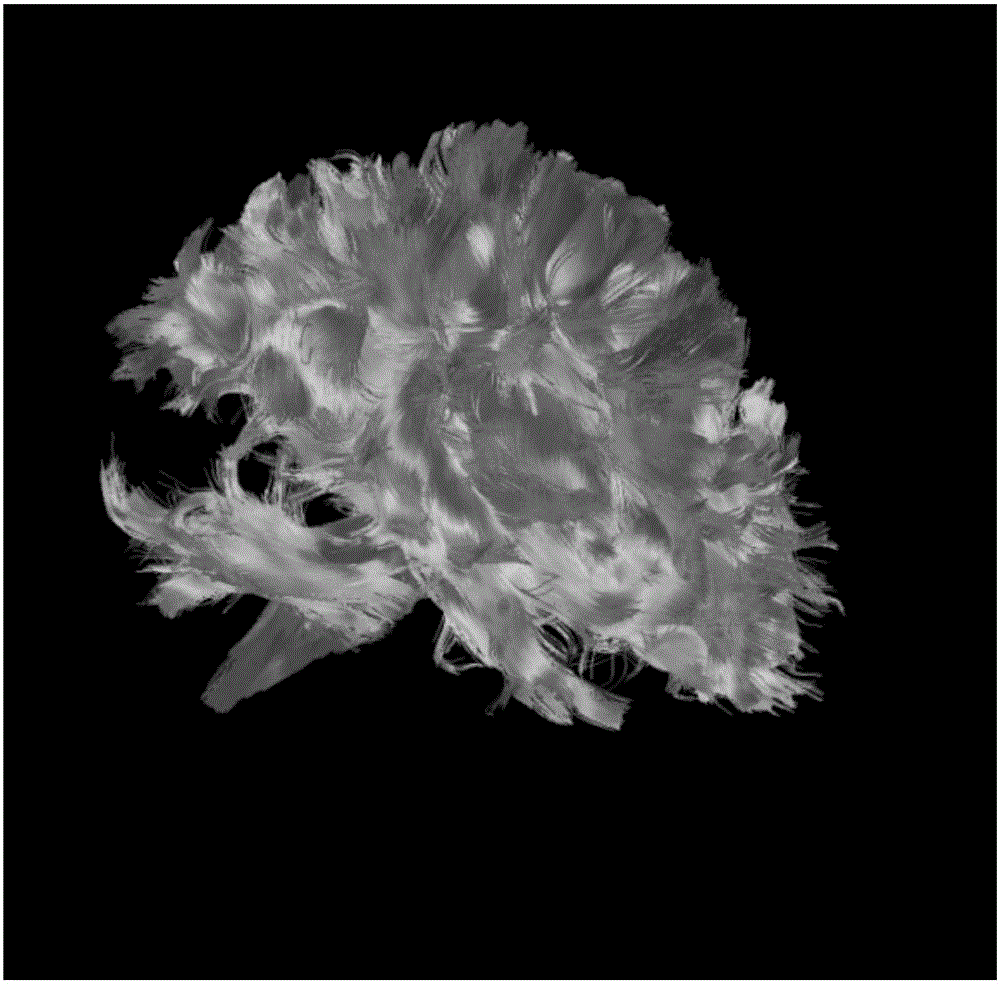 Interactive brain fiber selection and visualization method