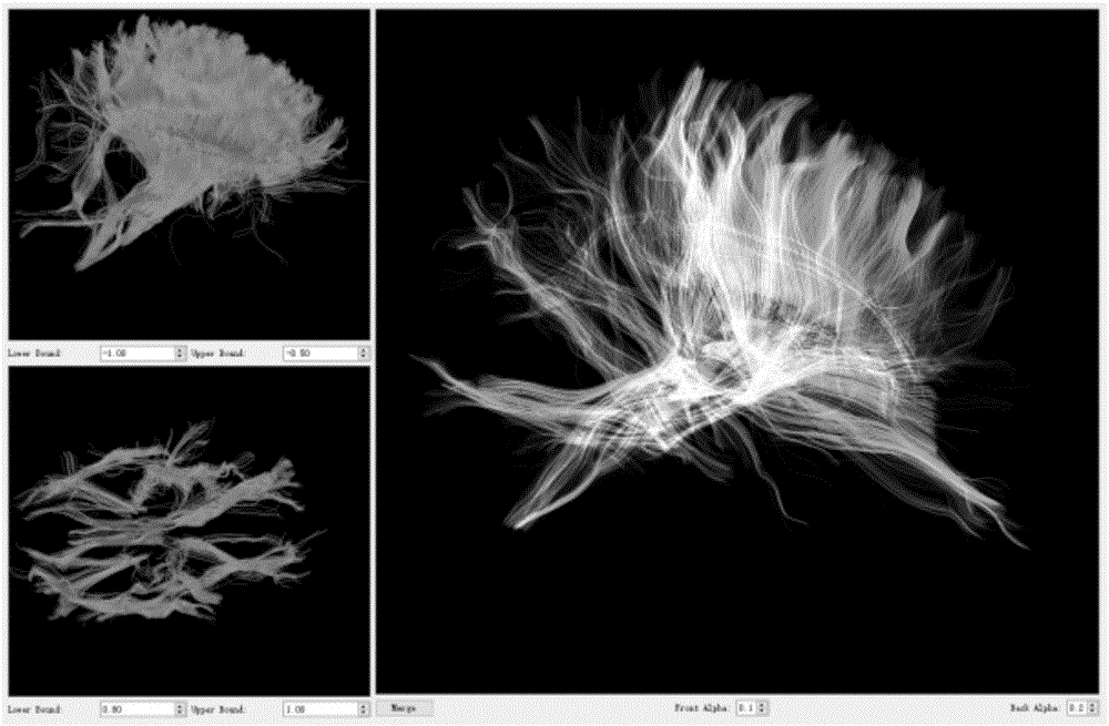 Interactive brain fiber selection and visualization method