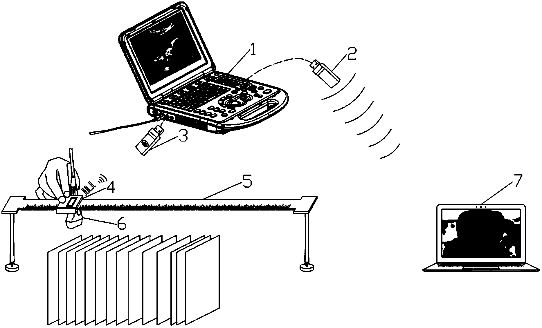 Wireless three-dimensional ultrasound imaging method and device