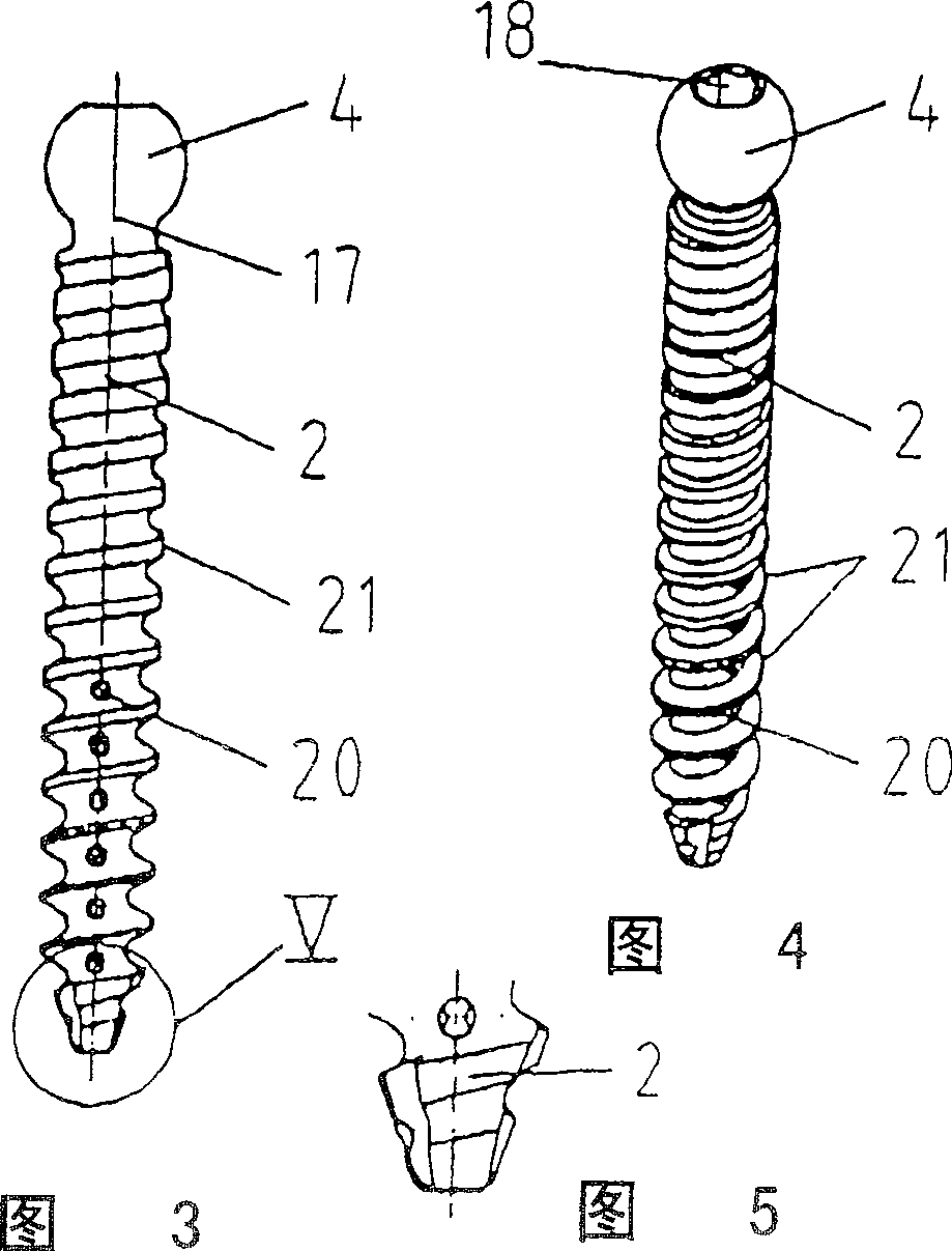 Embedded screw
