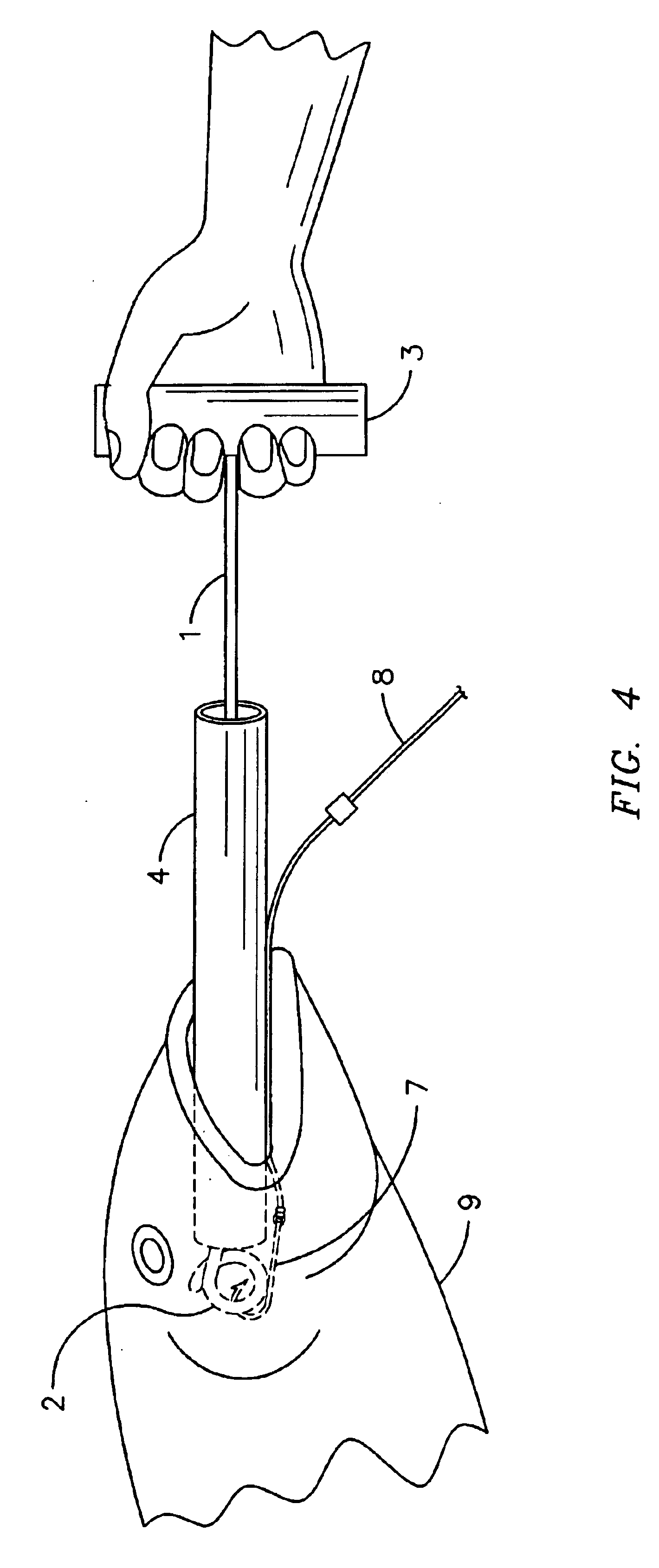 Dehooking device with slidable bite sleeve