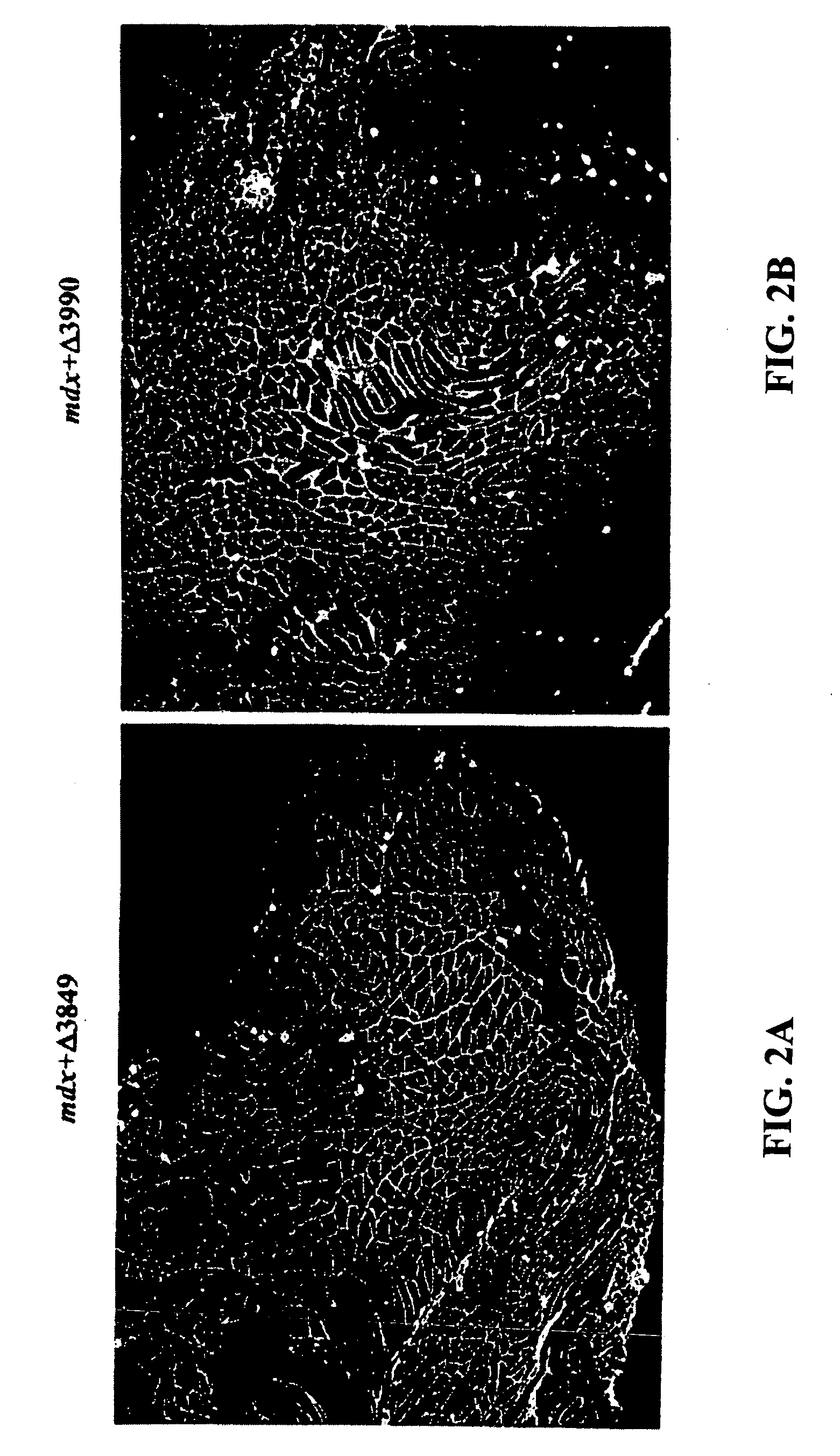 DNA sequences encoding dystrophin minigenes and methods of use thereof