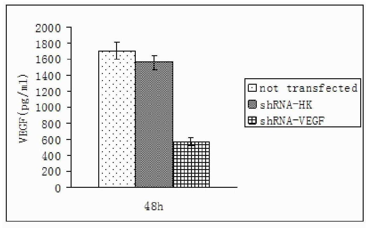 Composition of bFGF modified liposome and shRNA expression vector targeting human VEGF gene and preparation method thereof