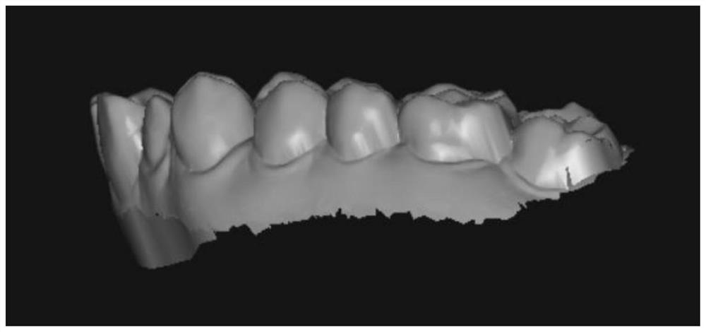 Manufacturing method of digital 3D printing soft elastic tooth protector