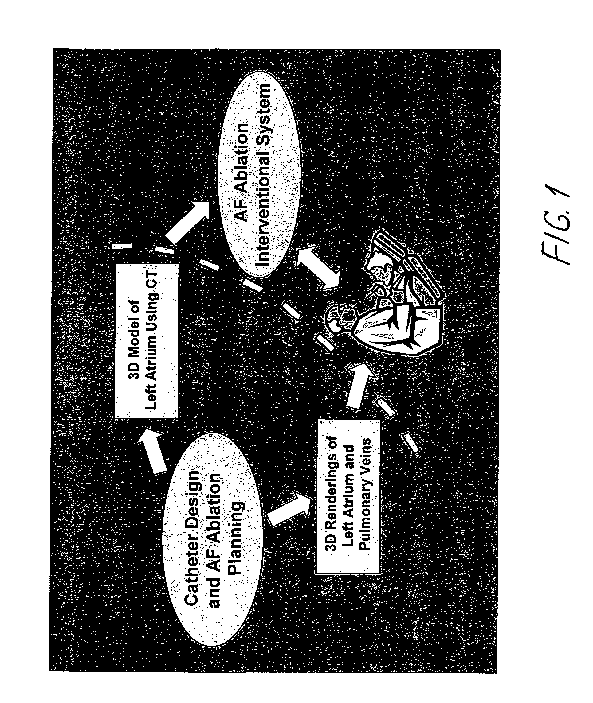 Method for pulmonary vein isolation and catheter ablation of other structures in the left atrium in atrial fibrillation