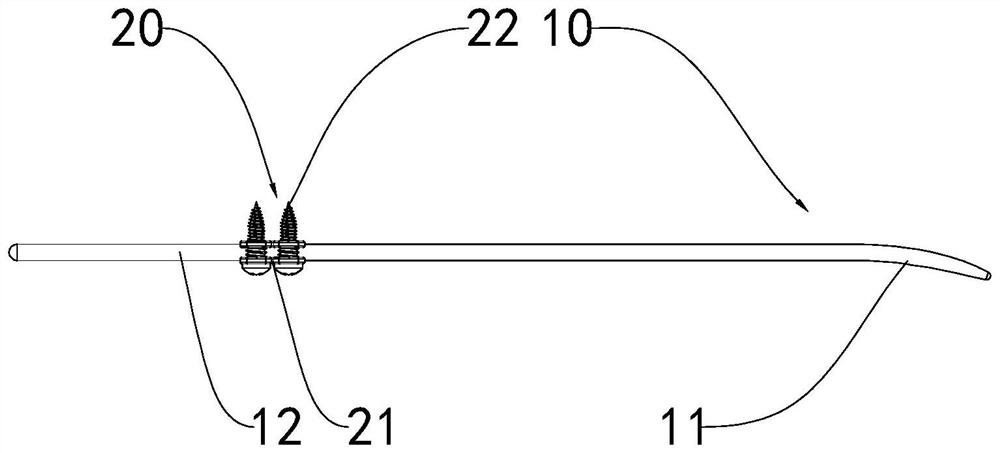 Clavicle intramedullary needle with terminal extramedullary locking function