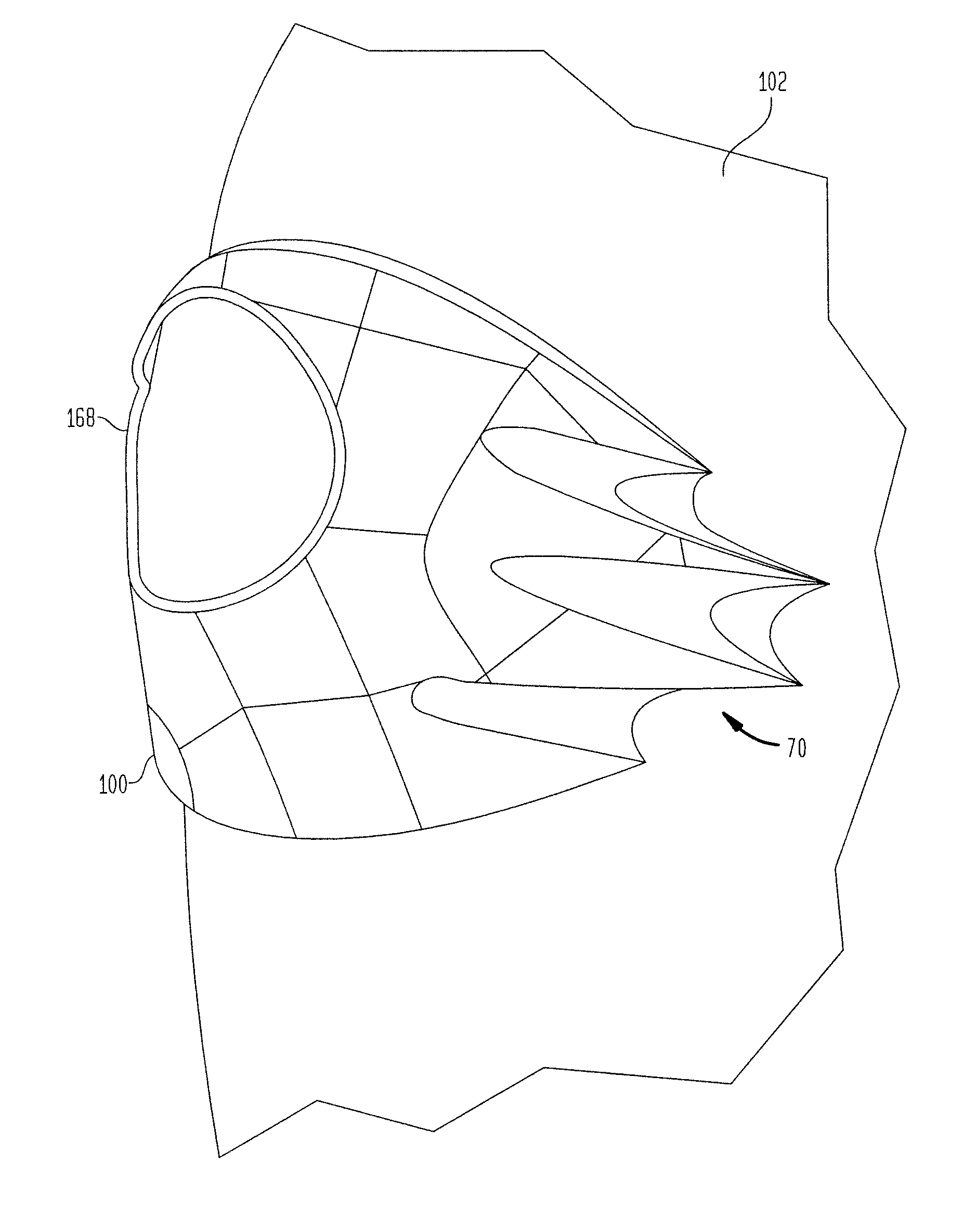 Protective anatomical pads and methods of making