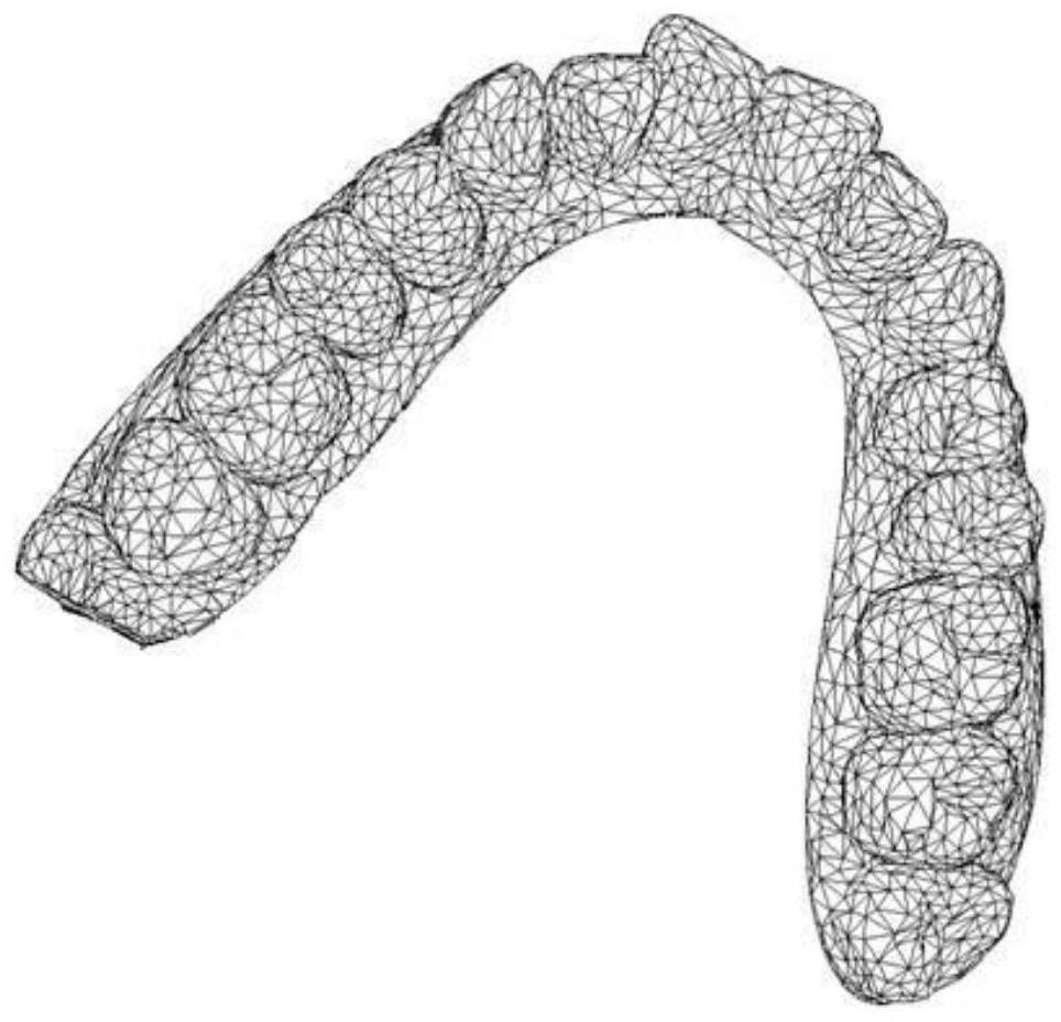 Preparation method of shell-shaped dental appliance