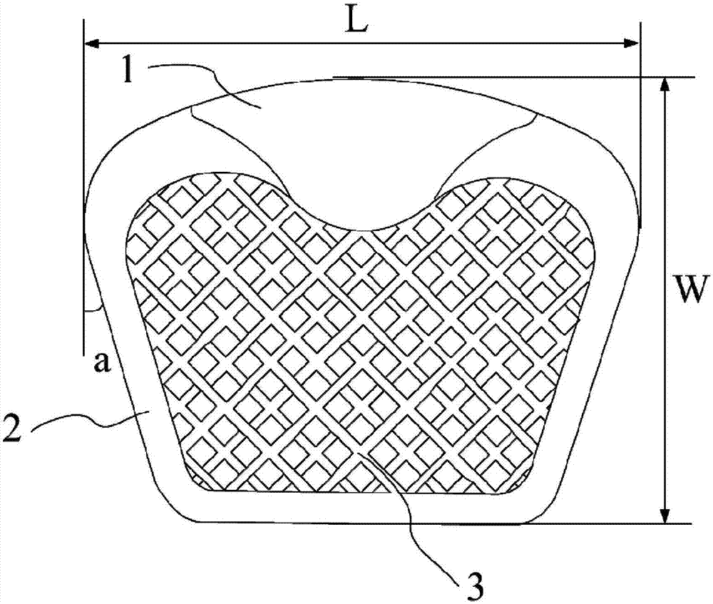 Porous titanium cervical fusion cage with HA coating and preparation method of fusion cage