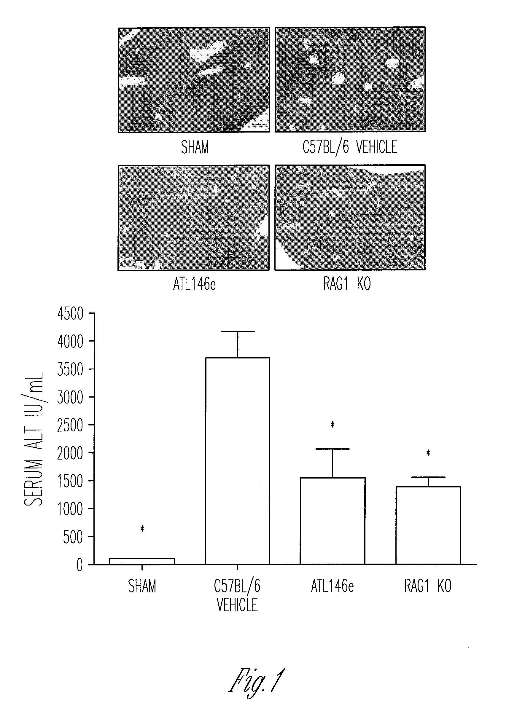 Method of treating ischemia reperfusion injury by inhibiting NKT cell activity