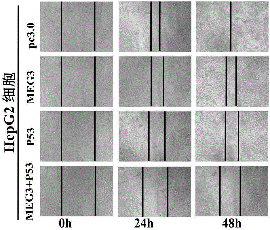 Liver targeting cationic polymer as well as preparation method and application thereof
