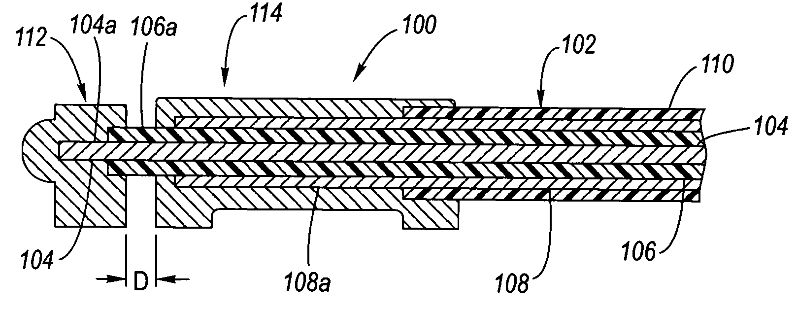 Coaxial cable termination system