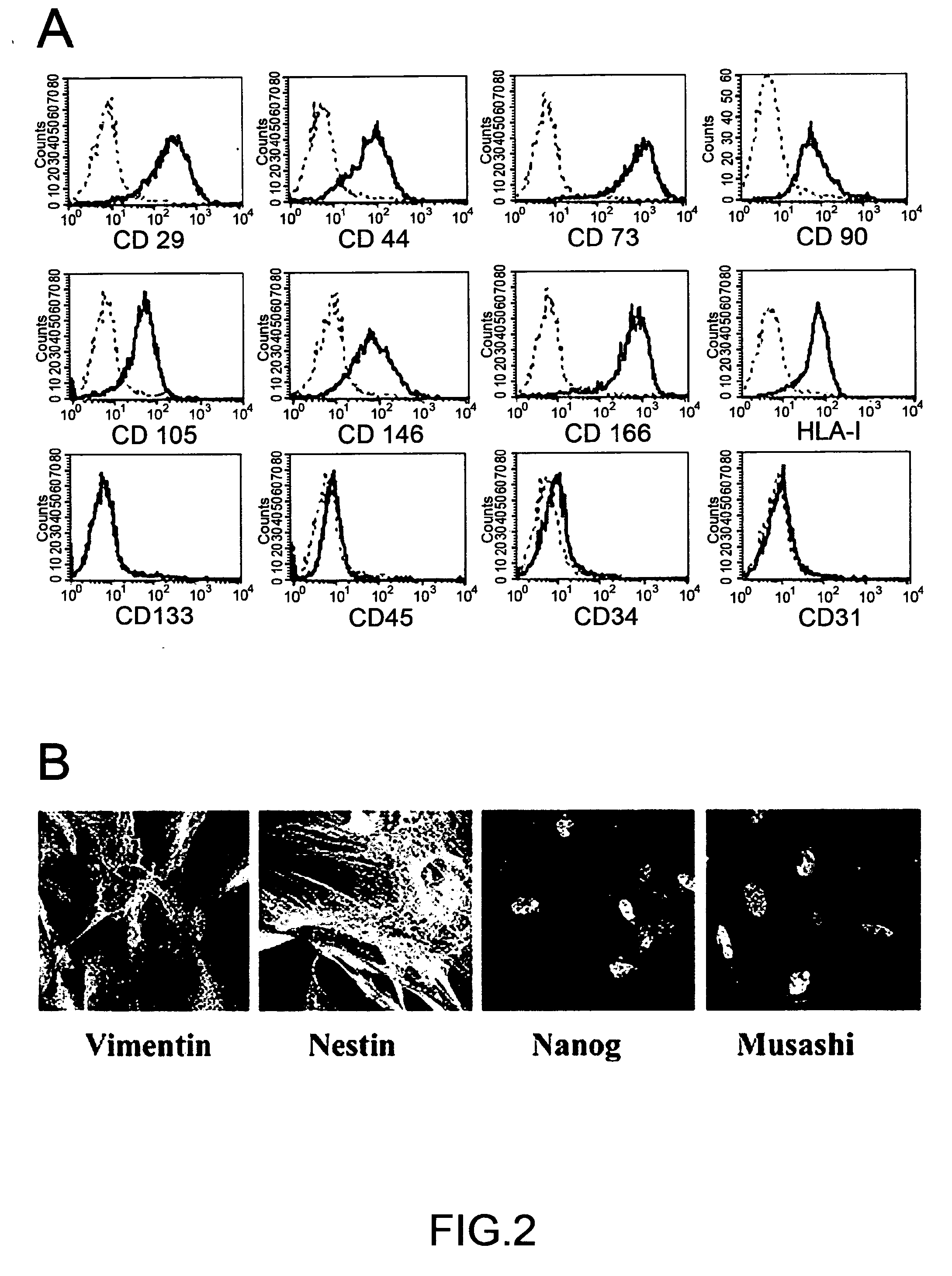 Isolated multipotent mesenchymal stem cell from human adult glomeruli (hgl-msc), a method of preparing thereof and uses thereof in the regenerative medicine of the kidney
