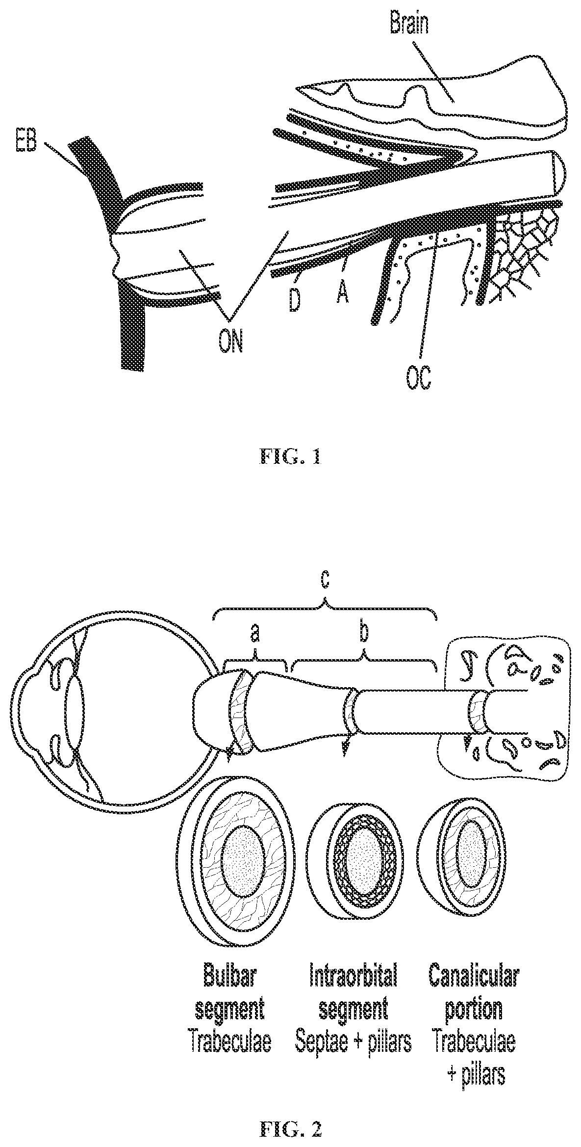 Systems and methods for detecting intracranial pressure and volume