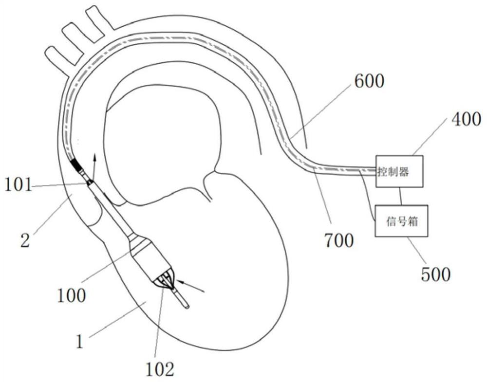 Ventricular auxiliary blood pumping instrument and system