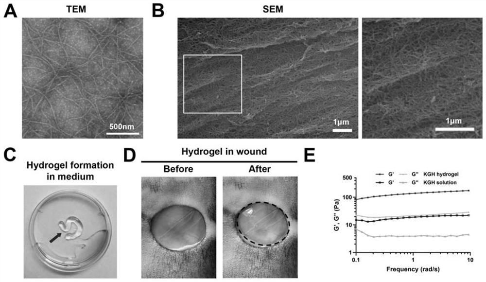 Polypeptide hydrogel for promoting skin repair as well as preparation method and application thereof