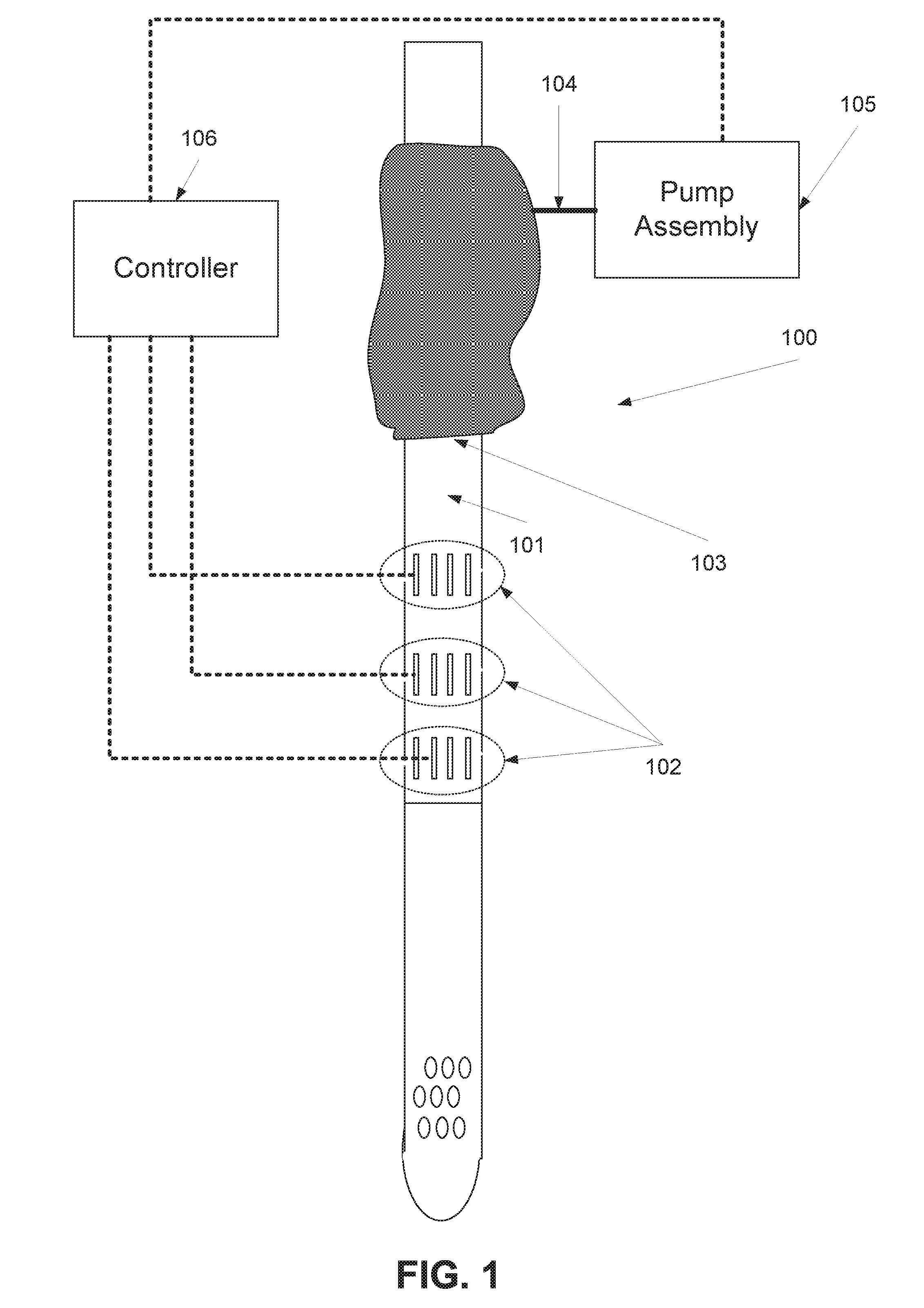 Method and device of detecting and/or blocking reflux