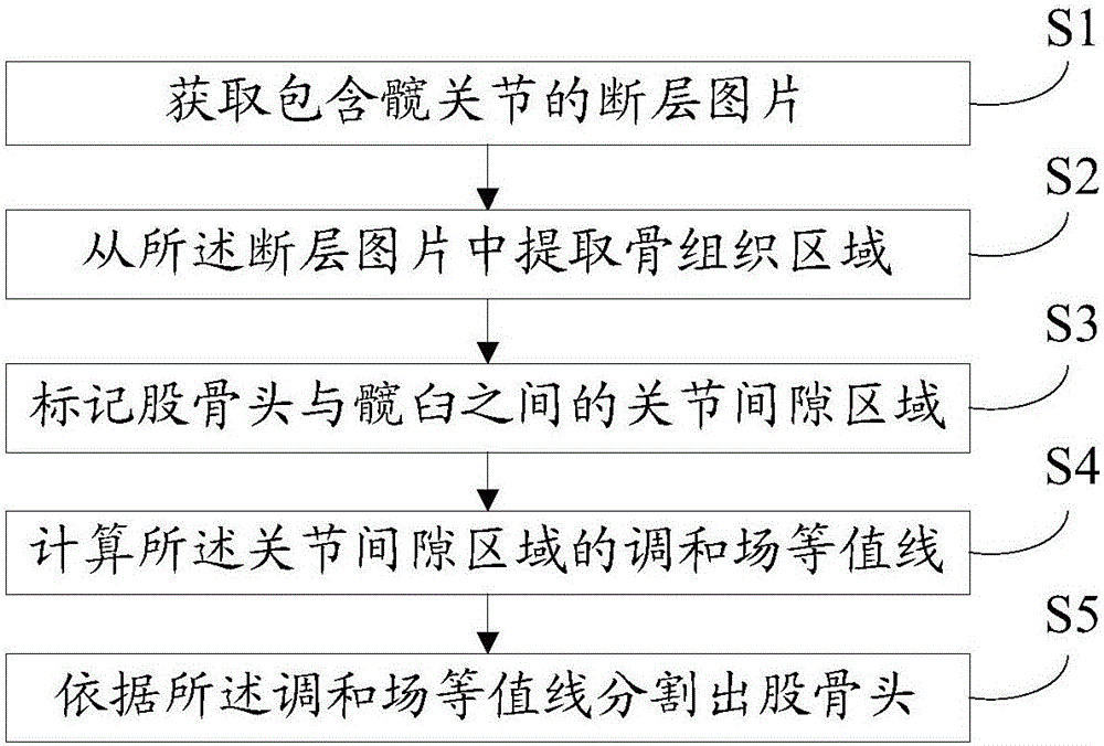 Femur segmenting method in tomographic image