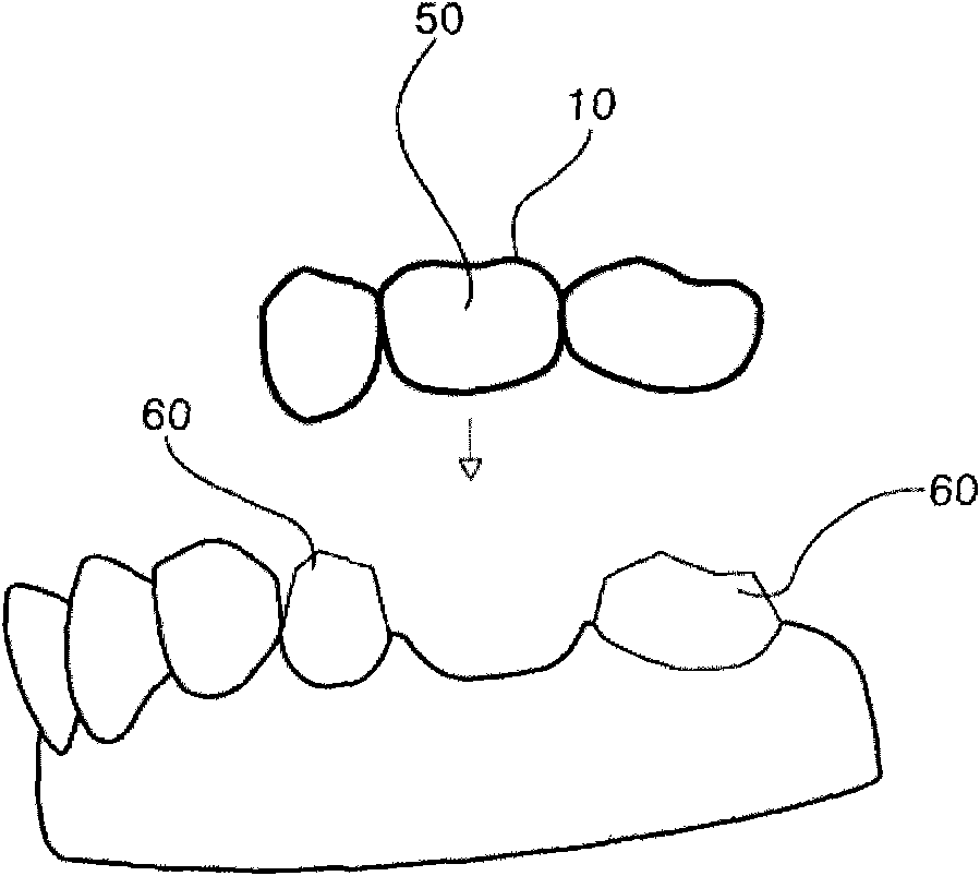 Device for repairing teeth and accessories thereof