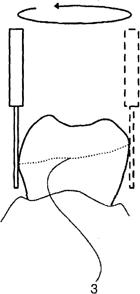 Device for repairing teeth and accessories thereof