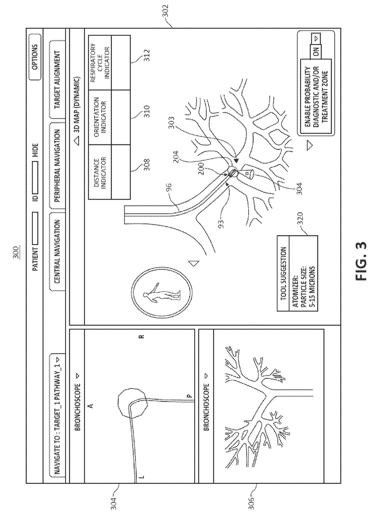 Systems and methods for navigational bronchoscopy and selective drug delivery