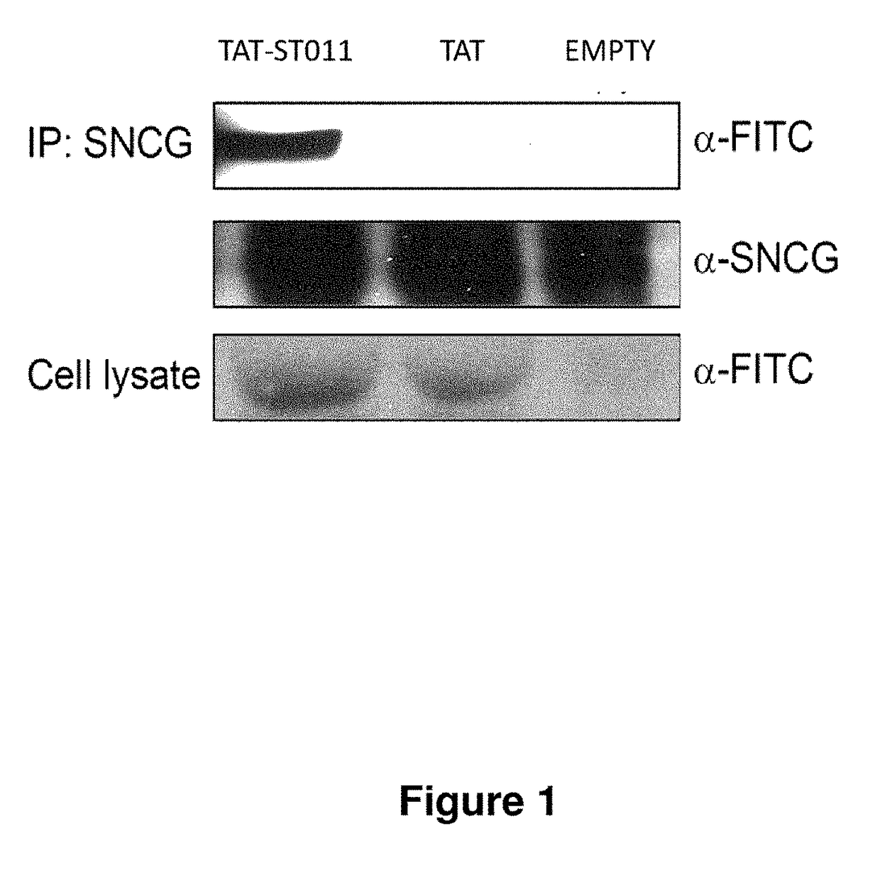 Treatment of endometriosis, angiogenesis and/or endometrial lesion growth