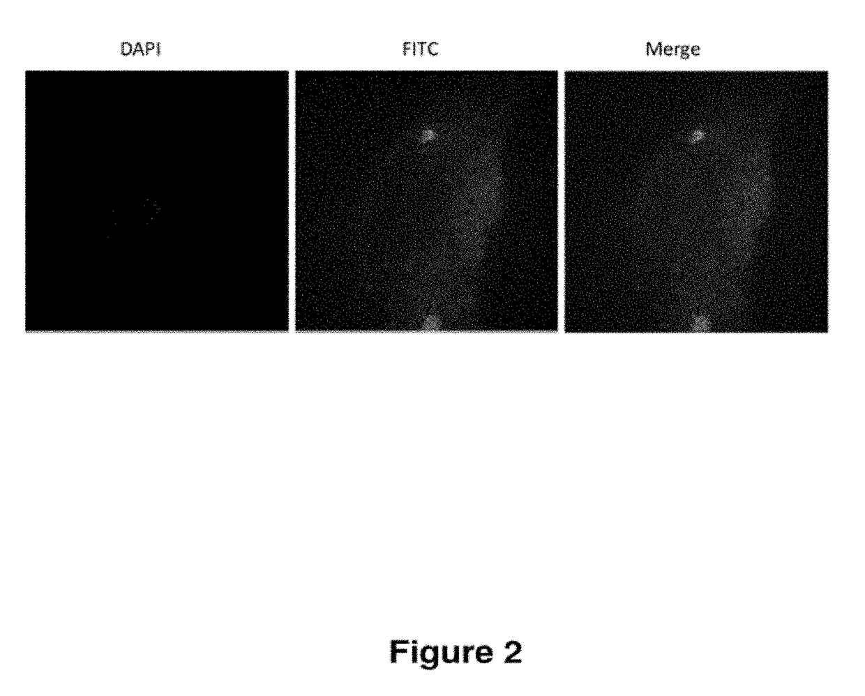 Treatment of endometriosis, angiogenesis and/or endometrial lesion growth