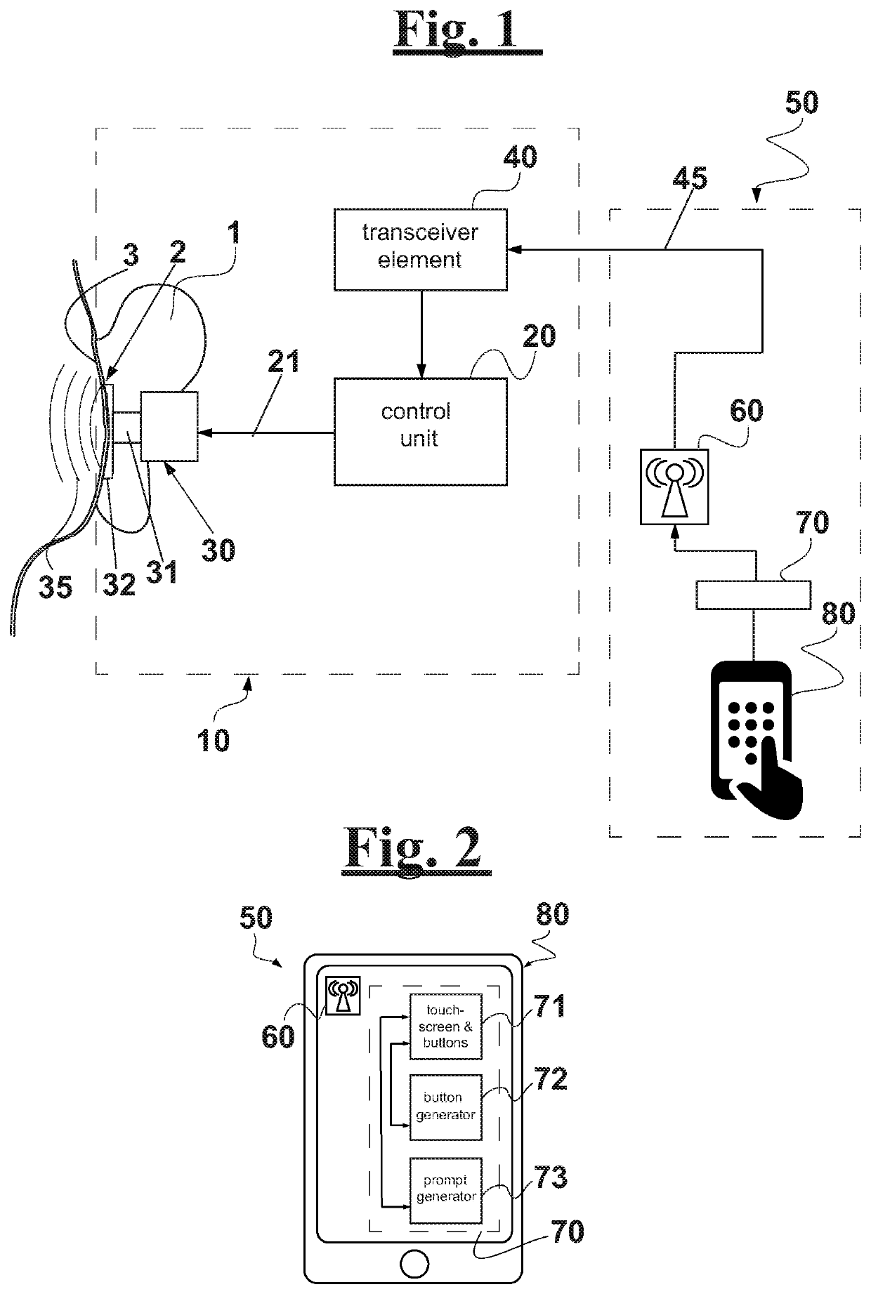 Electromechanical stimulation system for treating tinnitus