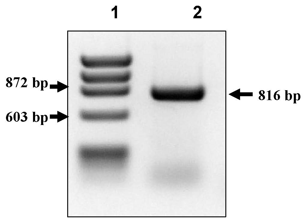 Auxotrophic, recombinant bcg strain pasteur and use thereof for combating human infections caused by parasites