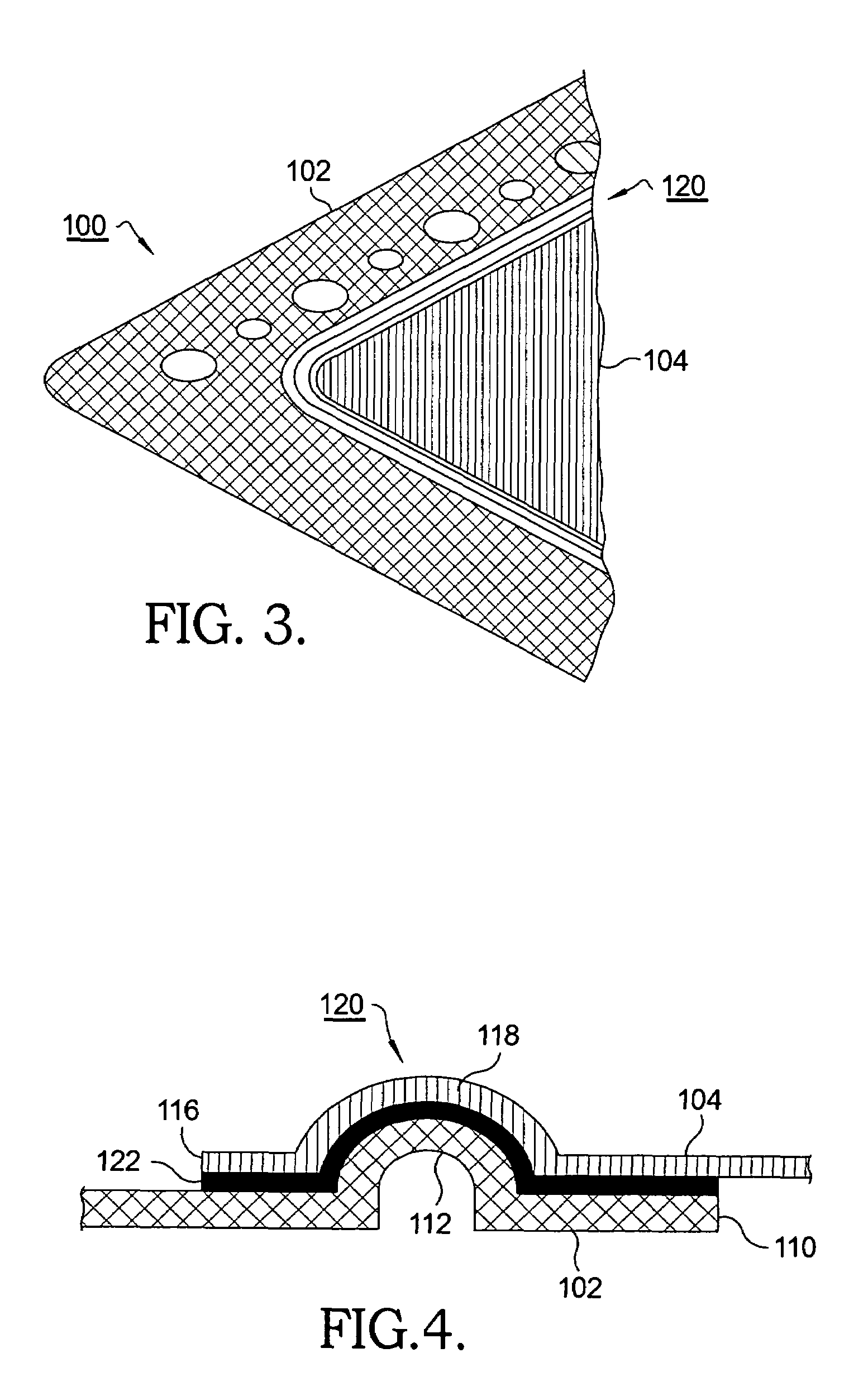 Hybrid interconnect for a solid-oxide fuel cell stack