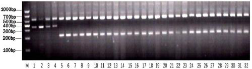General codominance molecular marker for resisting nilaparvata lugens Stal BPH9 multiple alleles of rice, and detection method and application of general codominance molecular marker